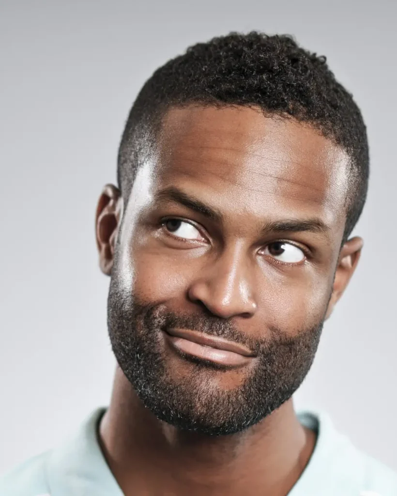 Afro Hair Transplant (2)